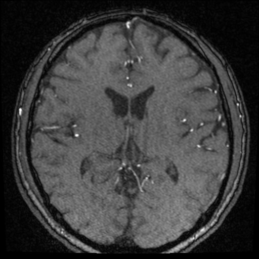 Click on the Serie image to view the images of VILLANUEVA, WILLIAM A.